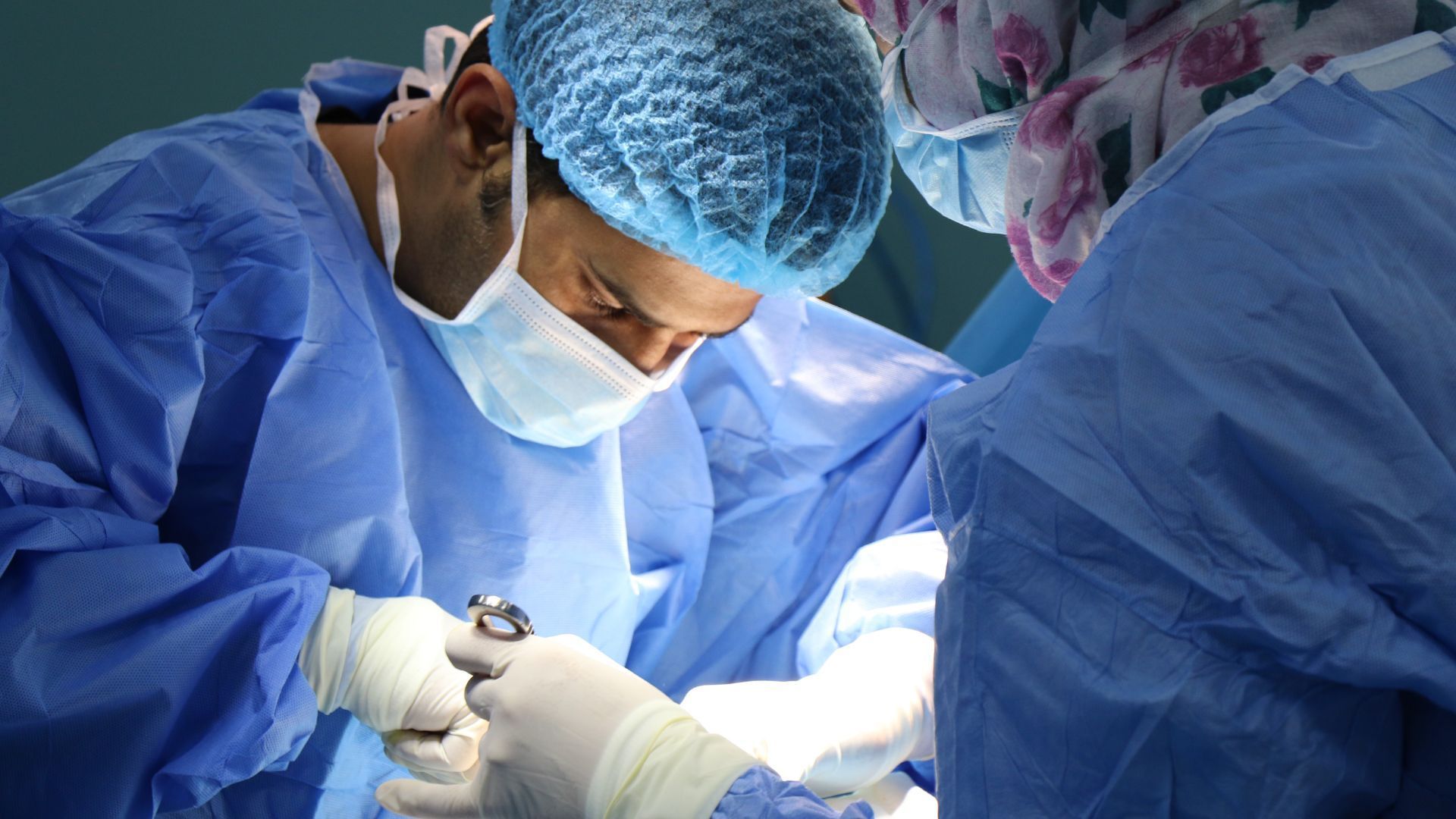 buccal fat removal
