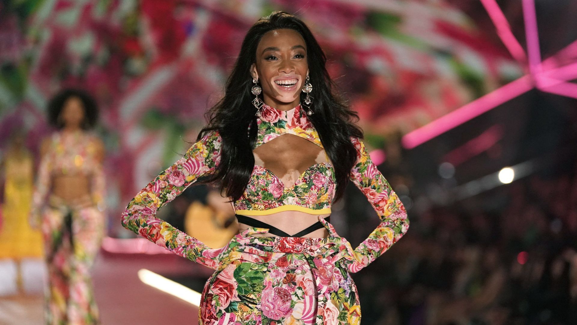 Winnie Harlow- victoria's secret show