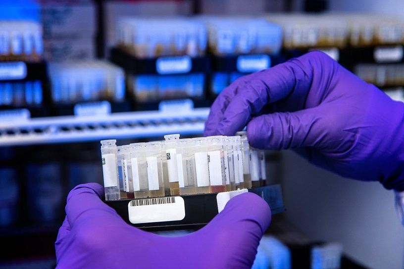 Antibody test