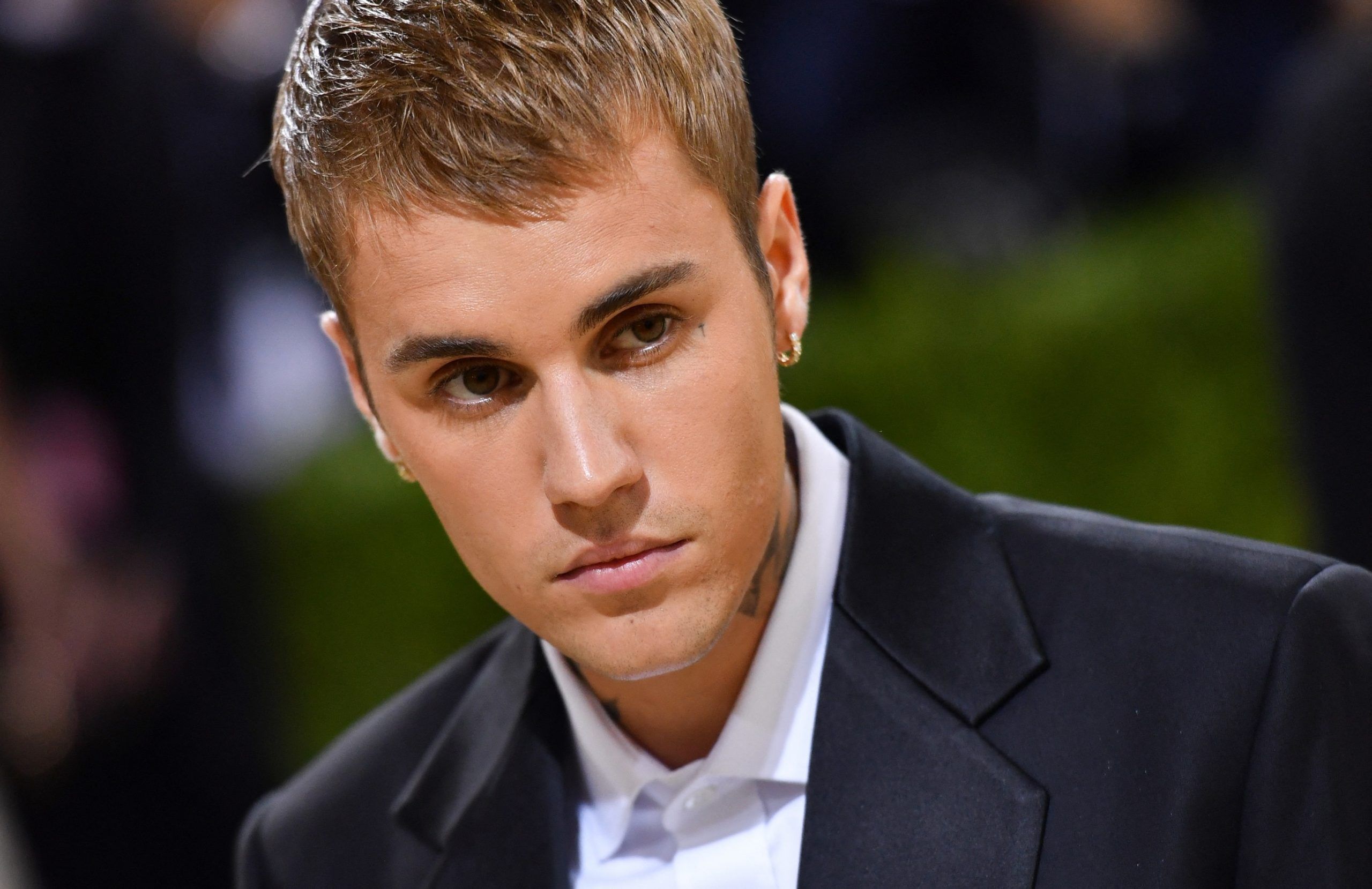 Justin Bieber Has Ramsay Hunt Syndrome — What Is It And Is It Curable 