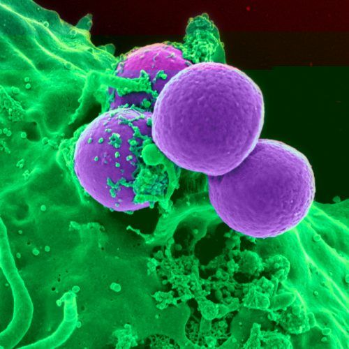 Mycoplasma Infection: Its Causes And Symptoms To Look Out For