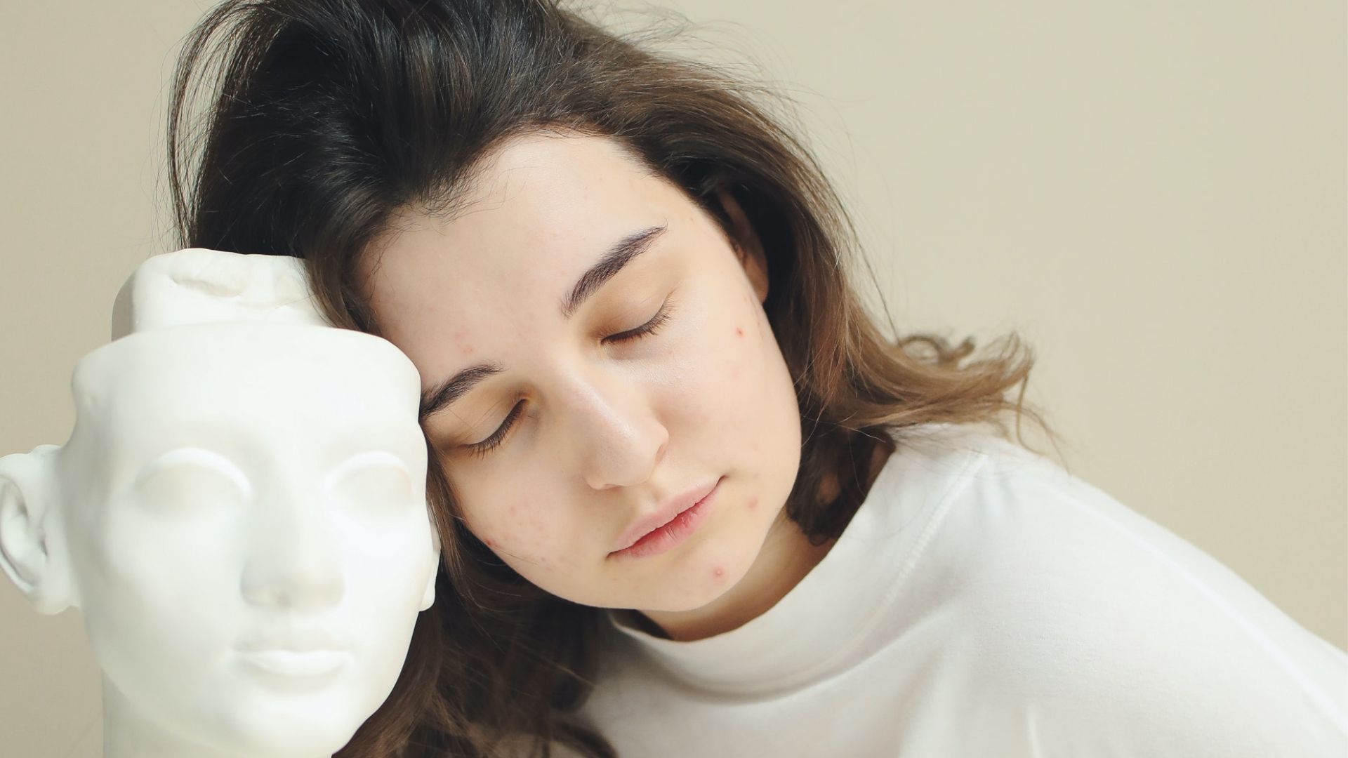 The Best Acne Treatments That Will Help You Flaunt Clear Skin