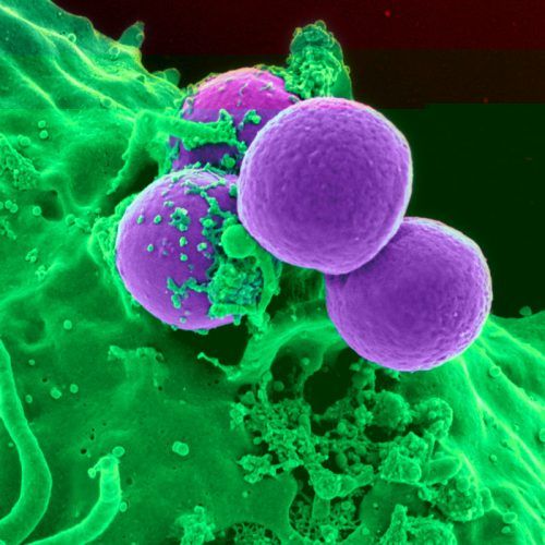 Mycoplasma Infection: What Is It And What Are Its Causes And Symptoms?